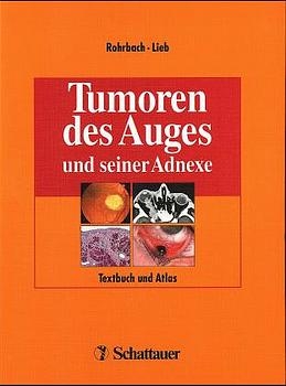 Tumoren des Auges und seiner Adnexe - Jens Martin Rohrbach, Wolfgang E Lieb, Karina Küper, Stefan Pfennigsdorf, Bettina Sandowski, Beate Sobotella, Helmut Wilhelm, Manfred Zährt