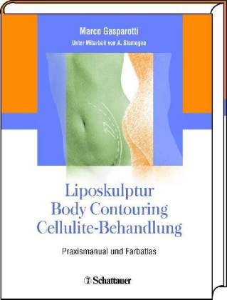 Liposkulptur - Body Contouring - Cellulite-Behandlung - Marco Gasparotti