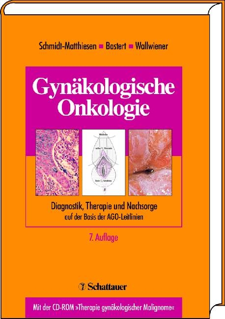 Gynäkologische Onkologie - 