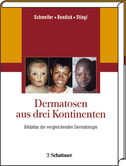 Dermatosen aus drei Kontinenten - Wilfried Schmeller, Christoph Bendick, Peter Stingl