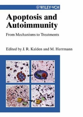 Apoptosis and Autoimmunity - 