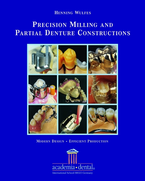 Precision Milling and Partial Denture Constructions: A Manual. Englische Ausgabe - Henning Wulfes