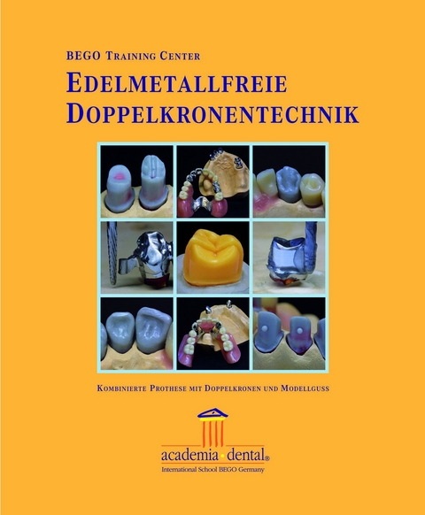 Edelmetallfreie Doppelkronentechnik - Henning Wulfes