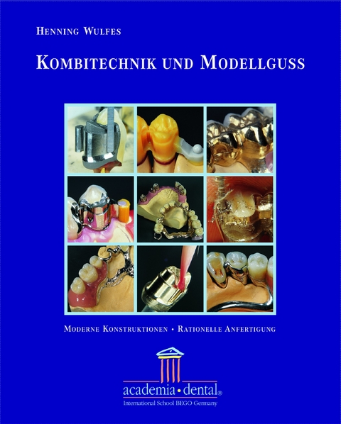 Kombitechnik und Modellguss: Ein Leitfaden - Henning Wulfes