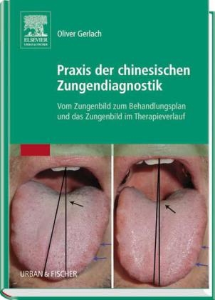 Praxis der chinesischen Zungendiagnostik - Oliver Gerlach