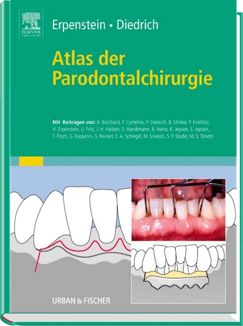 Atlas der Parodontalchirurgie - 