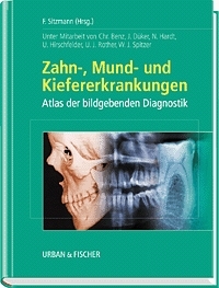 Zahn-, Mund- und Kiefererkrankungen - F Sitzmann, W J Spitzer, U Rother, U Hirschfelder