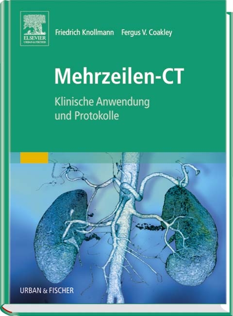 Mehrzeilen-CT - 