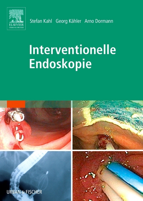 Interventionelle Endoskopie - 