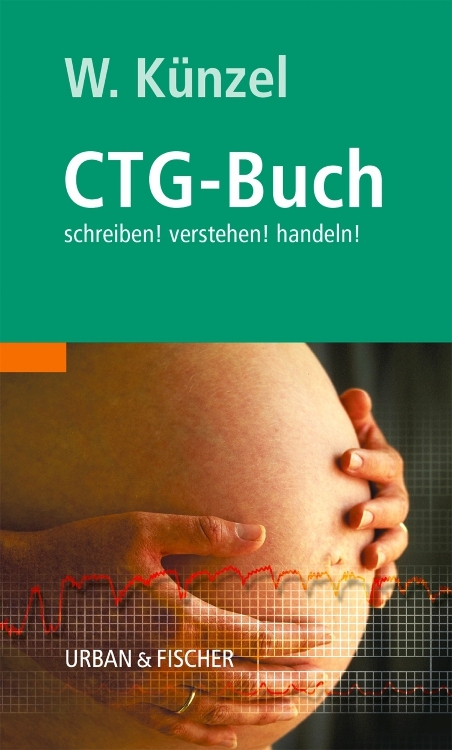Das CTG-Buch - Wolfgang Künzel