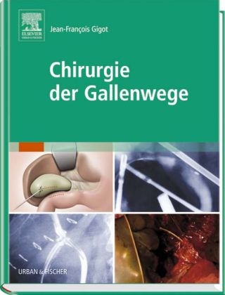 Chirurgie der Gallenwege - 