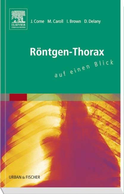 Röntgen-Thorax auf einen Blick - Jonathan Corne, Mary Caroll, Ivan Brown, David Delany