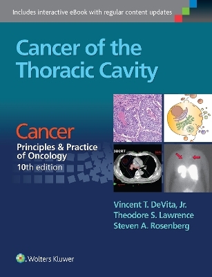 Cancer of the Thoracic Cavity - Vincent T DeVita  Jr., Theodore S. Lawrence, Steven A. Rosenberg