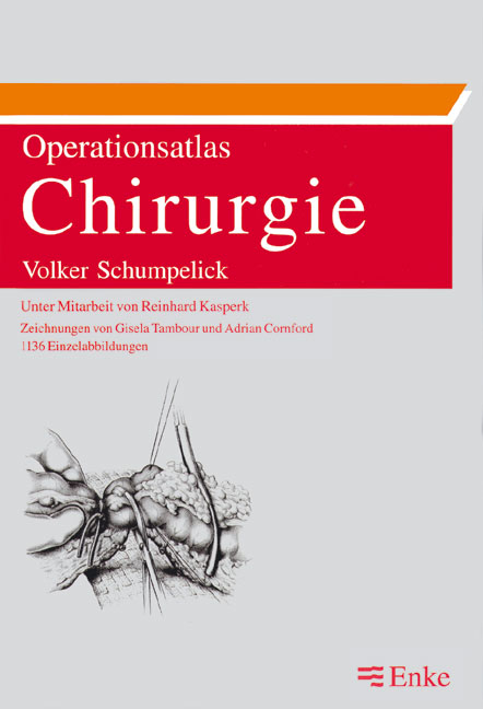 Operationsatlas Chirurgie - Volker Schumpelick