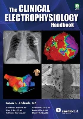 The Clinical Cardiac Electrophysiology Handbook - Jason G. Andrade, Matthew T. Bennett, Marc W. Deyell, Nathaniel Hawkins, Andrew D. Krahn