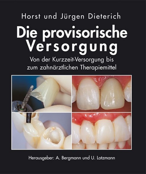 Die provisorische Versorgung - Horst Dieterich, Jürgen Dieterich