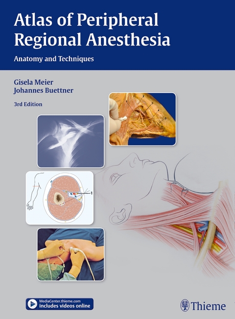 Atlas of Peripheral Regional Anesthesia - Gisela Meier, Johannes Buettner