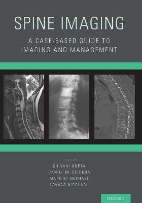 Spine Imaging - 