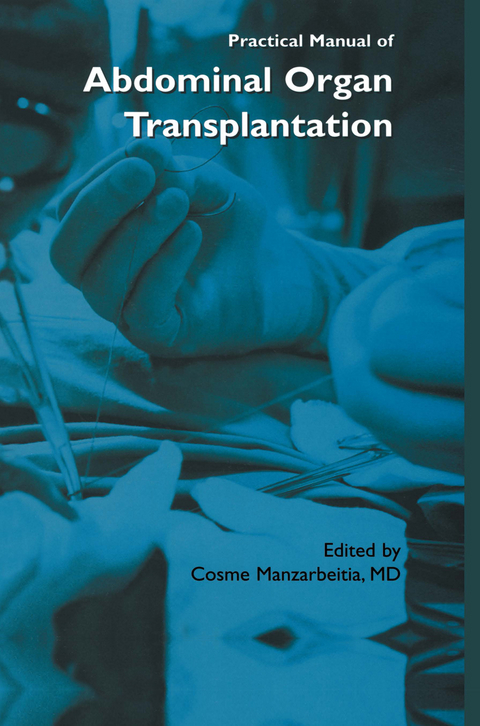 Practical Manual of Abdominal Organ Transplantation - 