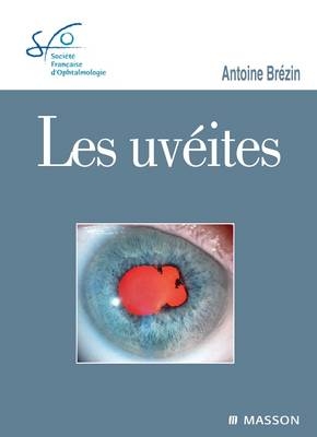 Les Uvéites - Antoine Brezin,  Societe Francaise D'Ophtalmologie (Sfo)