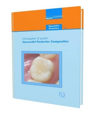 Successful Posterior Composites - Christopher Lynch