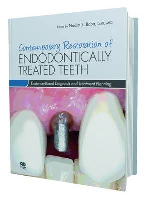 Contemporary Restoration of Endodontically Treated Teeth - Nadim Z. Baba