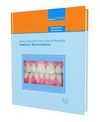 Indirect Restorations - David Bartlett