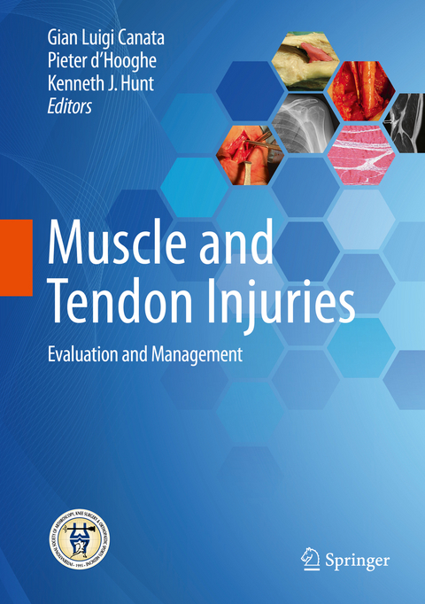 Muscle and Tendon Injuries - 
