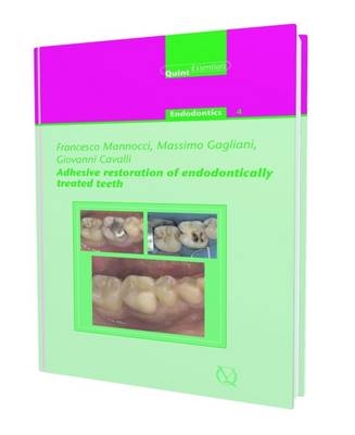 Adhesive Restoration of Endodontically Treated Teeth - Francesco Manocci, Giovanni Cavalli, Massimo Gagliani