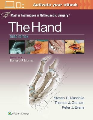 Master Techniques in Orthopaedic Surgery: The Hand - Dr. Steven Maschke, Thomas J. Graham, Dr. Peter Evans