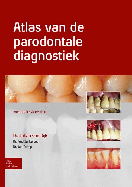 Atlas Van de Parodontale Diagnostiek - Johan Van Dijk, Fred Spijkervet, Jan Tromp