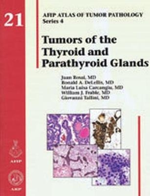 Tumors of the Thyroid and Parathyroid Glands - Juan Rosai, Ronald A. Delellis, Maria L. Carcangiu, William J. Frable, Giaovanni Tallini