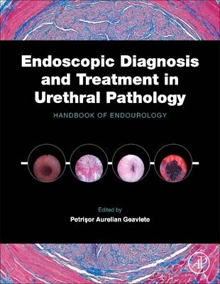 Endoscopic Diagnosis and Treatment in Urethral Pathology - 