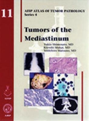 Tumors of the Mediastinum - Yukio Shimosato, Kiyoshi Mukai, Yoshihiro Matsuno