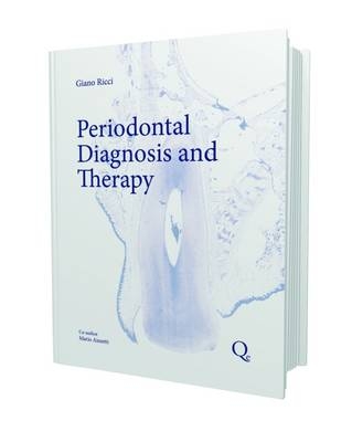 Periodontal Diagnosis and Therapy - Giano Ricci