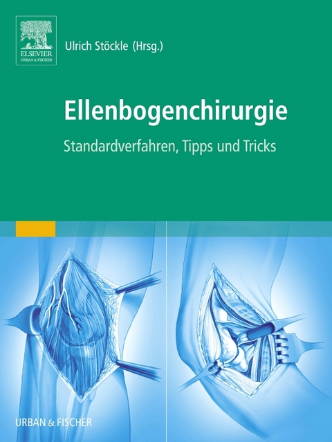 Ellenbogenchirurgie - 