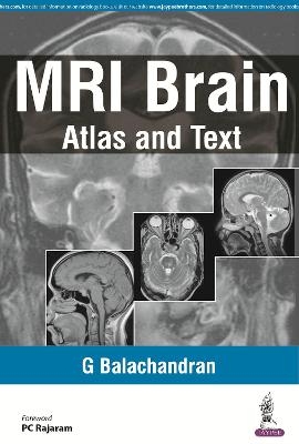 MRI Brain - G Balachandran