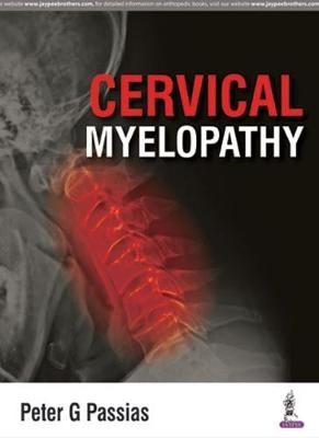 Cervical Myelopathy - Peter Passias