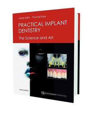Practical Implant Dentistry - Ashok Seth, Thomas Kaus