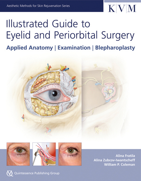 Illustrated Guide to Eyelid and Periorbital Surgery - Alina Fratila, William P. Coleman, Alina Zubcov-Iwantscheff
