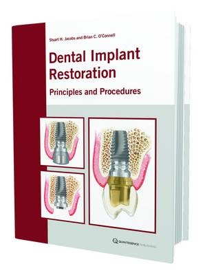 The Restoration of Dental Implants with Fixed Prosthesis - Stuart Jacobs, Brian O'Connell