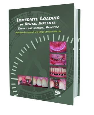 Immediate Loading of Implant Dentistry - Mithridate Davarpanah, Serge Szmukler-Moncler