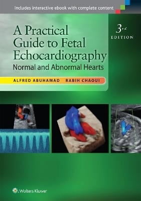 A Practical Guide to Fetal Echocardiography - Alfred Z. Abuhamad, Rabih Chaoui