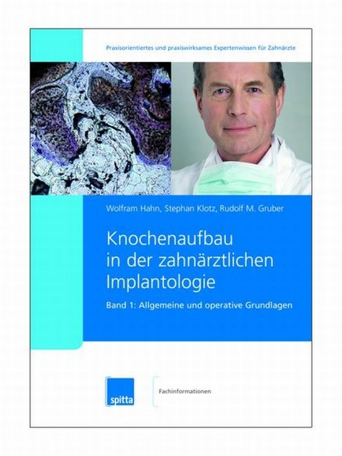 Knochenaufbau in der zahnärztlichen Implantologie. 2007/2008. Band 1 + 2 / Allgemeine und operative Grundlagen - Wolfram Hahn, Stephan Klotz, Rudolf M Gruber