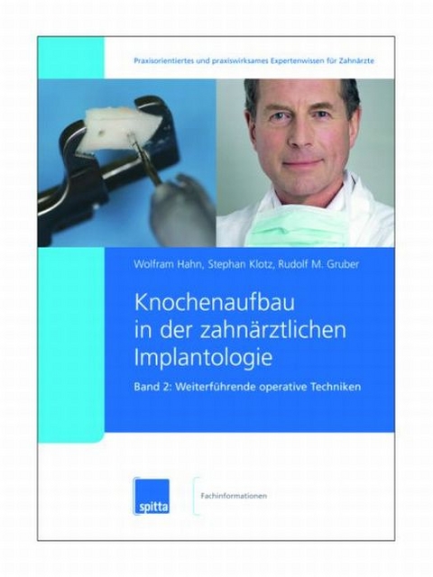 Knochenaufbau in der zahnärztlichen Implantologie. 2007/2008. Band 1 + 2 / Weiterführende operative Techniken - Wolfram Hahn, Stephan Klotz, Rudolf M Gruber