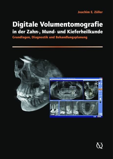 Digitale Volumentomografie in der Zahnmedizin - 