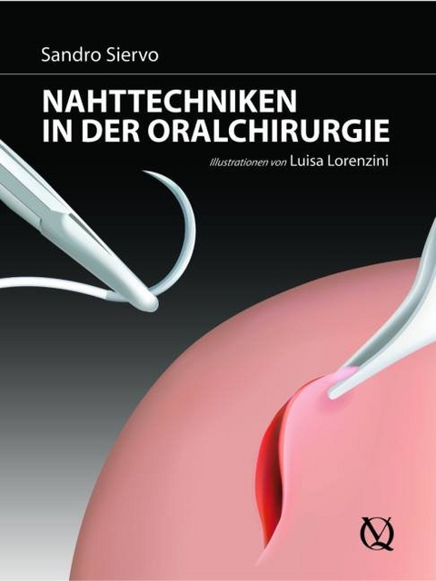 Nahttechniken in der oralen Chirurgie - Sandro Siervo