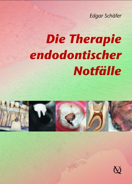 Die Therapie endodontischer Notfälle - Edgar Schäfer