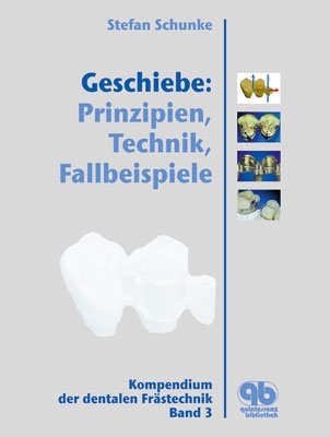 Geschiebe: Prinzipien, Technik, Fallbeispiele - Stefan Schunke