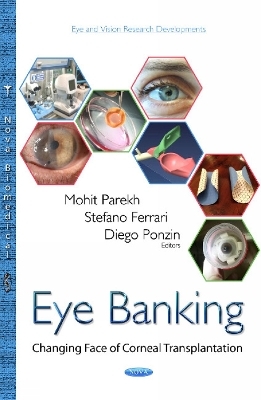 Eye Banking - 